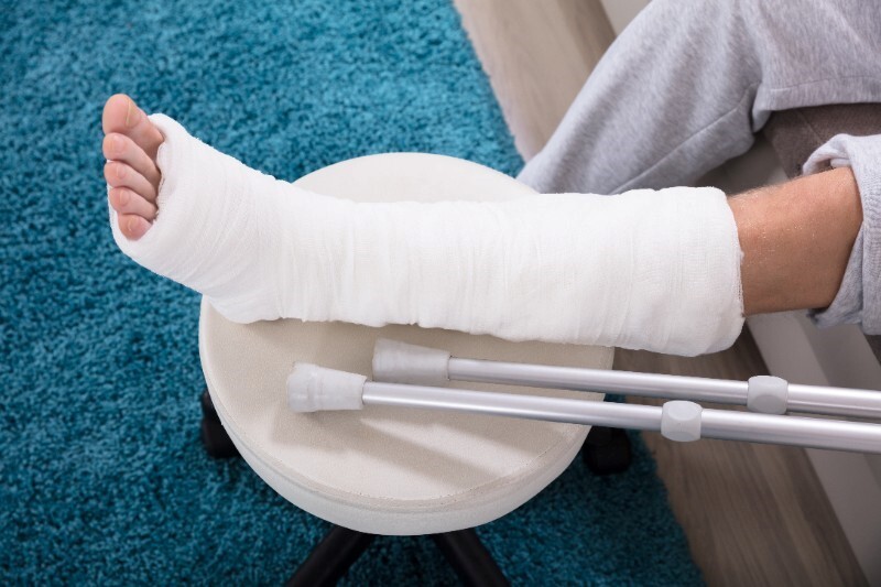 Fliegen mit Gips